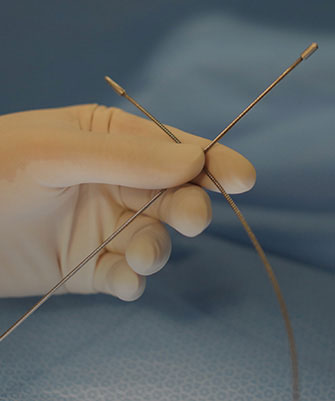 절개술,발거술,스트리핑